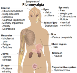 fibromyalgia-symptoms_0b10af0b10af000000
