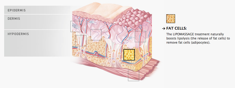Discover Endermologie's non-invasive and risk-free solution for double chins.
