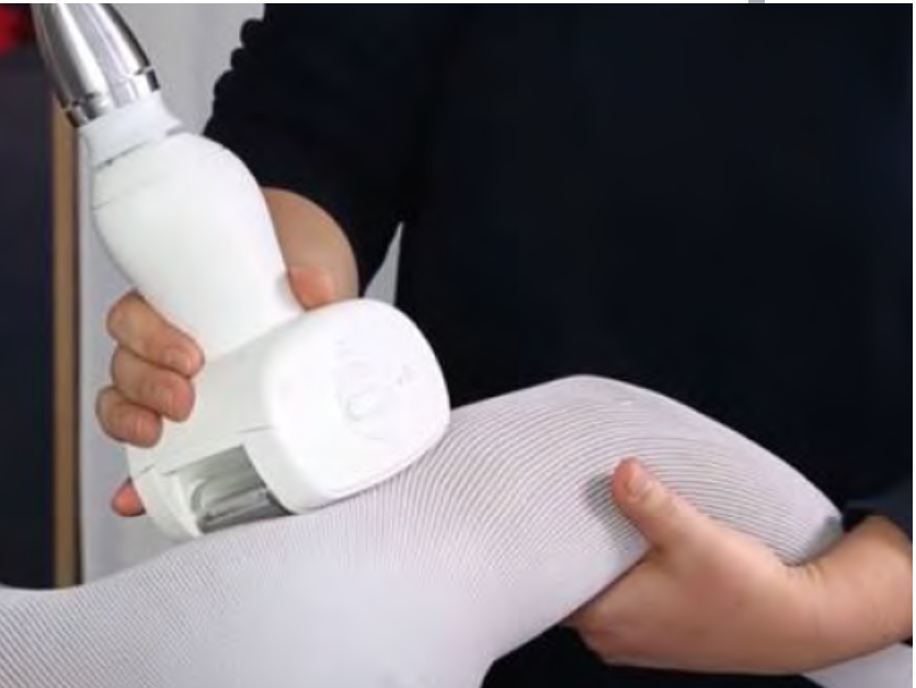 Endermologie for lymphoedema Oedema