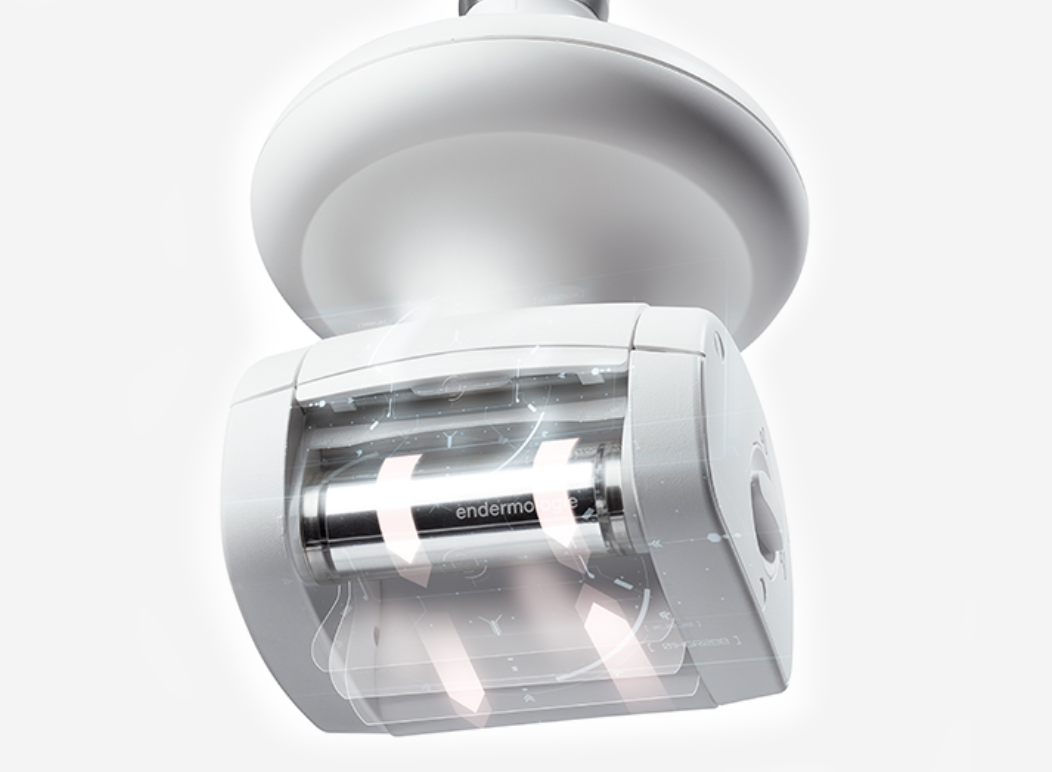Endermologie for Lipoedema relieves symptoms of lipoedema Lipoedema treatment